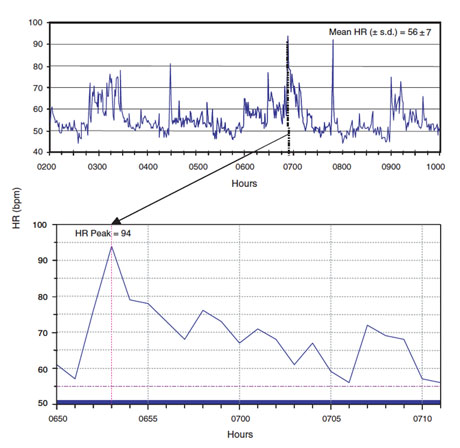 Heartrate Anderson paper 460