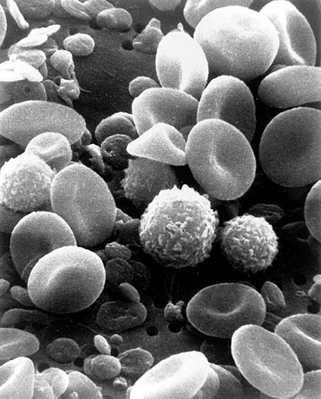 SEM_blood_cells 460